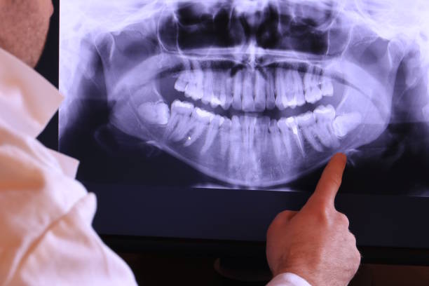 Best After-Hours Emergency Dentist in Morristown, TN